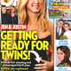 Illustration for article titled This Week in Tabloids: Here's a Picture of Taylor Swift's Breast Implant Scar